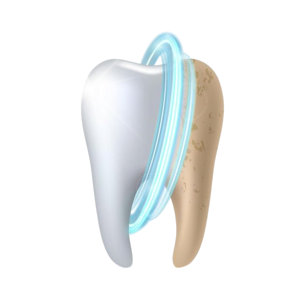 Teeth Cleaning in Kochi Edappally